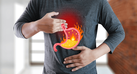 Acid Reflux GERD