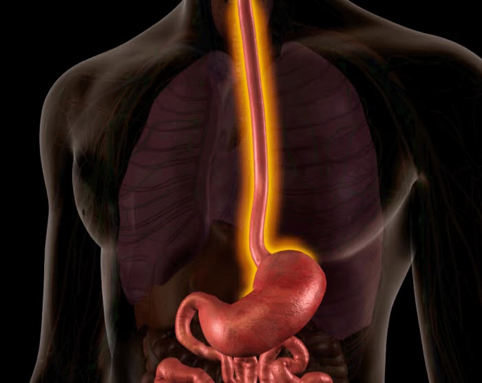 Esophagus Treatment