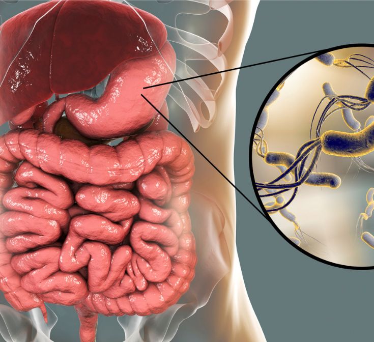 H. pylori Infection Treatment in South Delhi