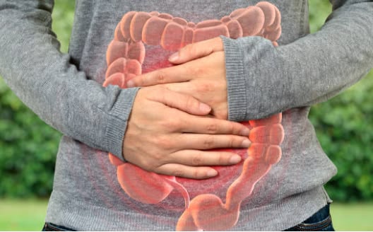 Irritable Bowel Syndrome